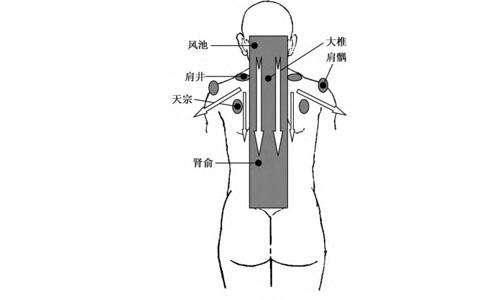 颈椎痛刮痧有作用吗 颈椎痛刮痧有作用吗视频