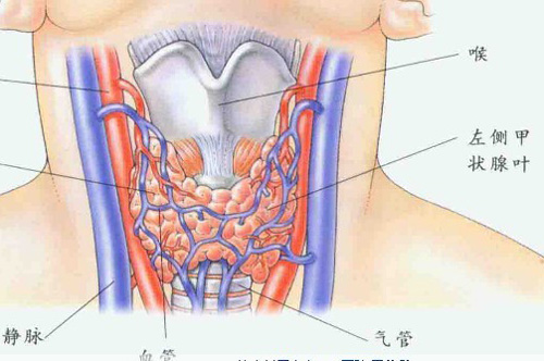 甲状腺癌的早期症状 甲状腺癌的早期症状4a