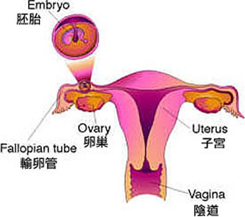 什么是宫外孕