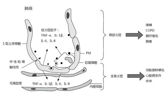 雾霾到底会不会致癌（雾霾会导致什么）