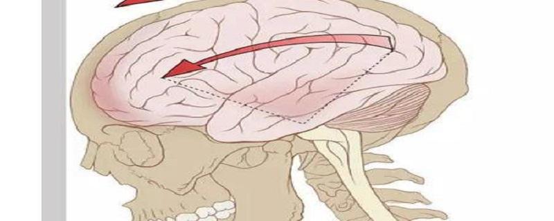 脑震荡的主要临床表现（脑震荡的主要临床表现不正确的是）