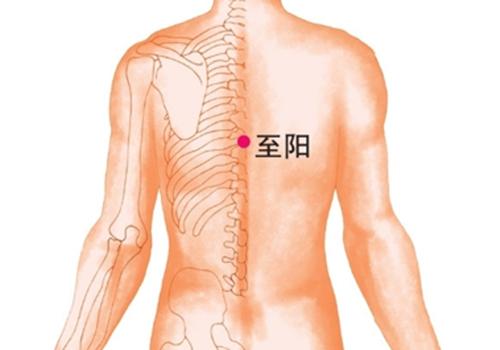 男性拔罐的位置图图解（拔罐的部位图）