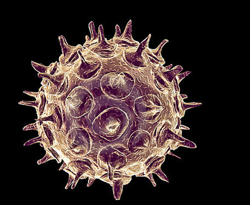 带状疱疹是怎么引起的 带状疱疹是怎么引起的 初期