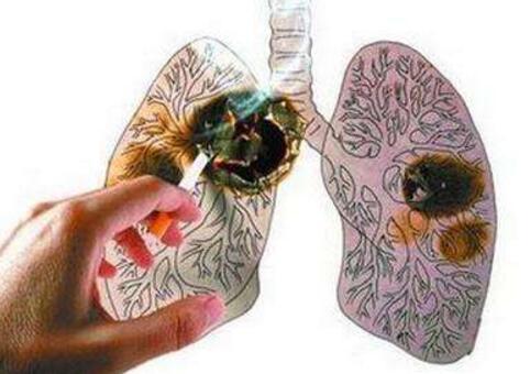 肺癌是什么原因引起的（老人肺癌是什么原因引起的）