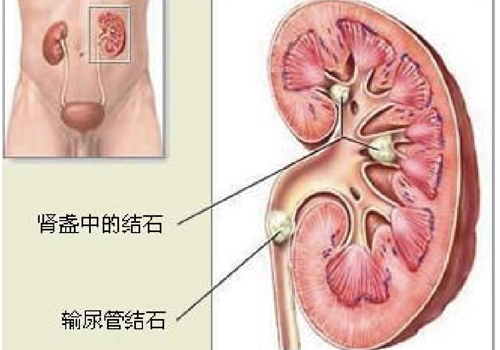 肚子胀尿少怎么回事（肚子胀尿的少怎么回事）