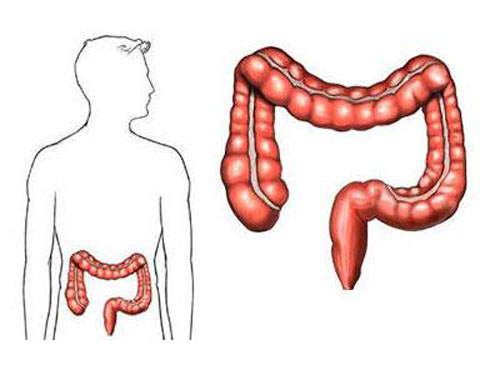 肠癌的早期症状 肠癌的早期症状有哪些肠