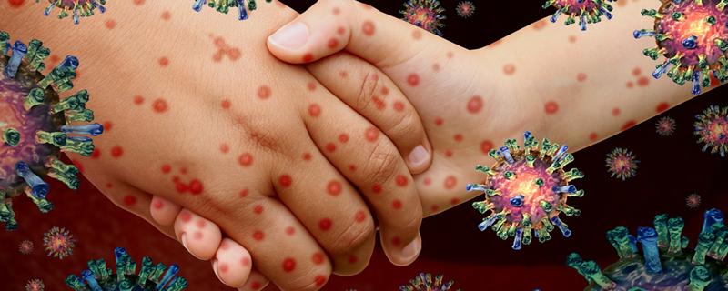 蚊虫水泡和病毒水泡的区别 疱疹病毒是什么引起的