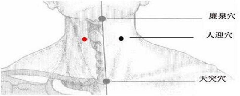 人迎针刺方法（人迎针刺注意事项）