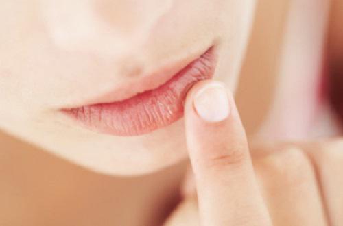 嘴唇干裂脱皮缺少什么维生素 嘴唇干裂脱皮缺乏什么维生素