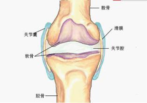 滑膜炎怎么治疗最有效 老人滑膜炎怎么治疗最有效