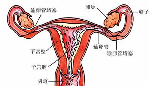 输卵管堵塞的表现（输卵管堵塞有什么样症状）