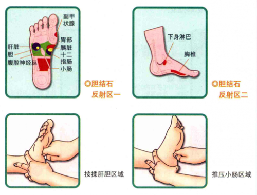 胆结石按什么什么穴位有效 胆结石按摩哪个位置