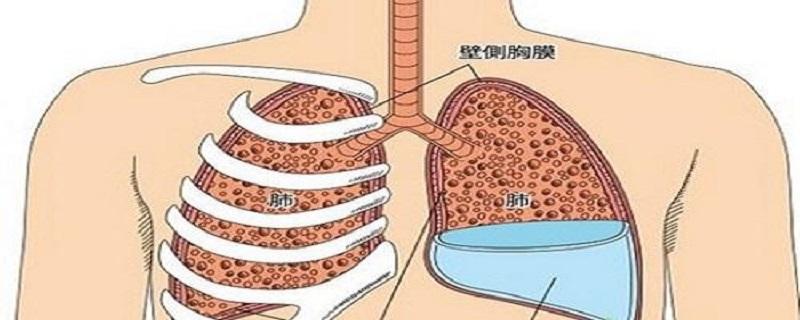 胸腔积液是怎么形成的 双侧有少量的胸腔积液是怎么形成的