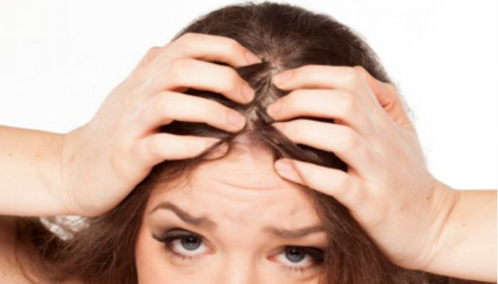 怎样扎头发发际线不会后移 如何扎头发防止发际线后移