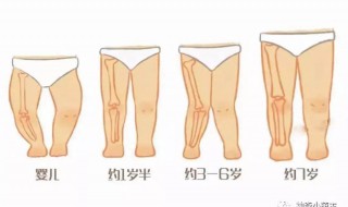 学生0型腿怎么矫正（学生o型腿怎么矫正）