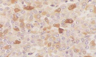 细胞可分化为 细胞分化为什么mrna改变,trna,rrna不变?