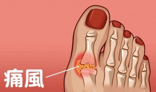 痛风一般在什么部位（痛风一般在什么部位痛）