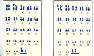 人的染色体有多少对 24对染色体分别是什么