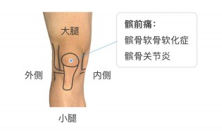 髌骨是哪个部位 髌骨是哪个部位图片