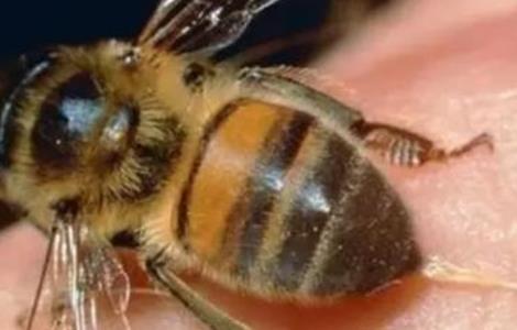 被蜜蜂蜇了该怎么办