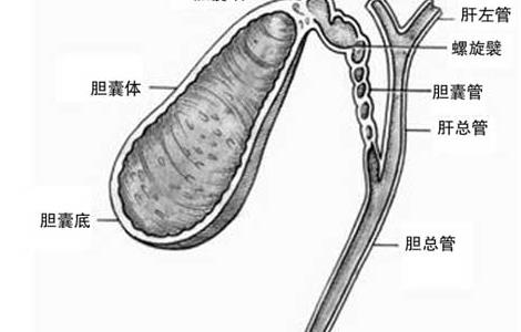 胆结石不能吃什么食物