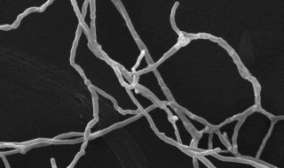 菌丝体与子实体有什么不同 菌丝体 子实体