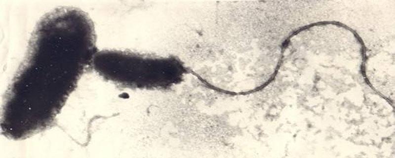 蛭弧菌在水产为何禁用 蛭弧菌在水产养殖中的危害
