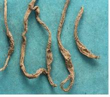 黄花菜根的功效与作用 黄花菜根的功效与作用是什么