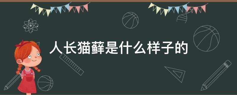 人长猫藓是什么样子的 人长猫藓是什么样子的和上火红肿怎么区分