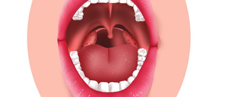 舌苔经常出血是什么问题 舌苔经常出血是什么问题女性