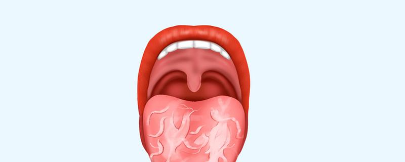 裂纹舌怎么治疗（地图舌和裂纹舌怎么治疗）
