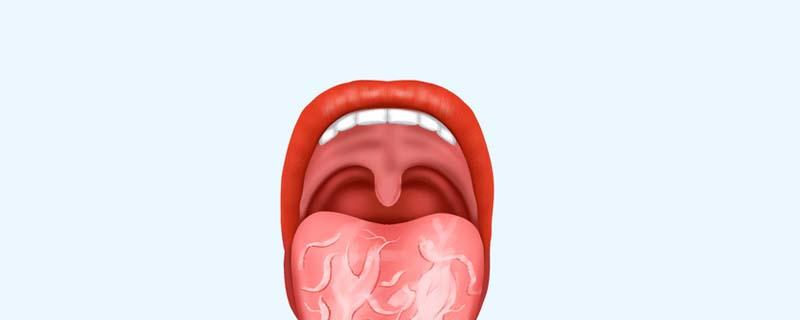 裂纹舌不能吃什么东西 裂纹舌吃什么食物