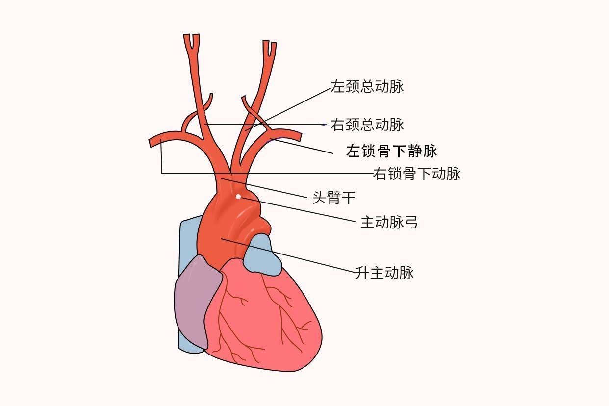 主动脉弓解剖图（主动脉弓解剖图高清）