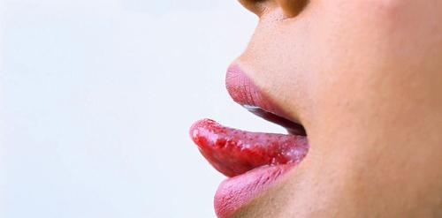 舌癌的早期症状（舌癌的早期症状图片）