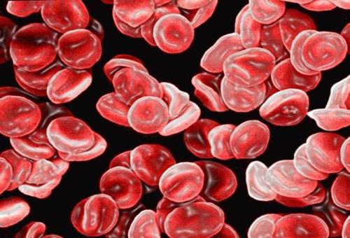 血红蛋白浓度偏低 血红蛋白浓度偏低是什么原因