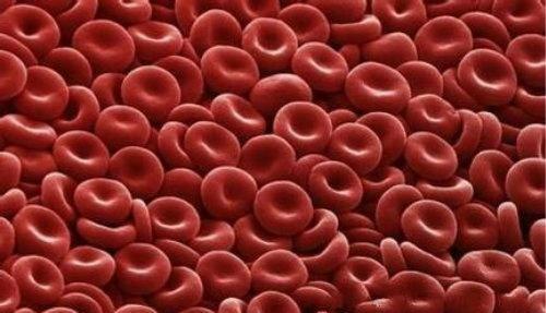 红细胞压积 红细胞压积偏低