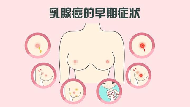 如何选择适合自己的内衣 女人的胸部是挑选内衣重要指标