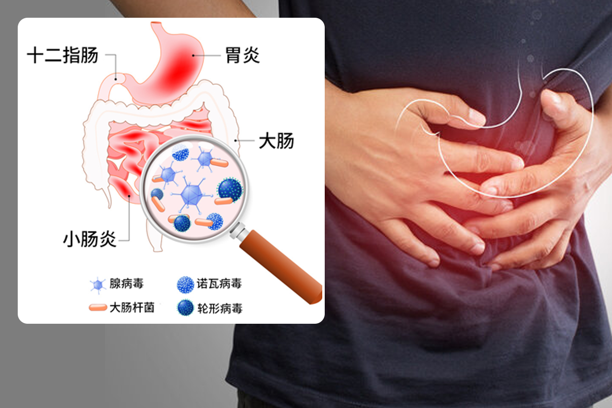 急性胃炎图片（急性胃炎图片做胃镜工具图片）