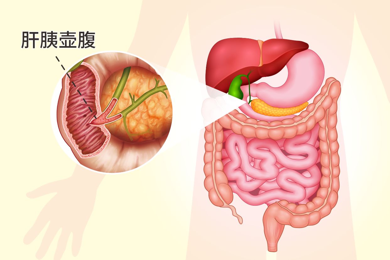 肝胰壶腹部在哪个位置图片 肝胰壶腹部解剖图