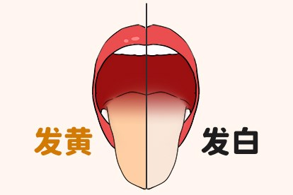 舌苔厚白和厚黄的区别图片 舌苔厚白和舌苔厚黄的区别