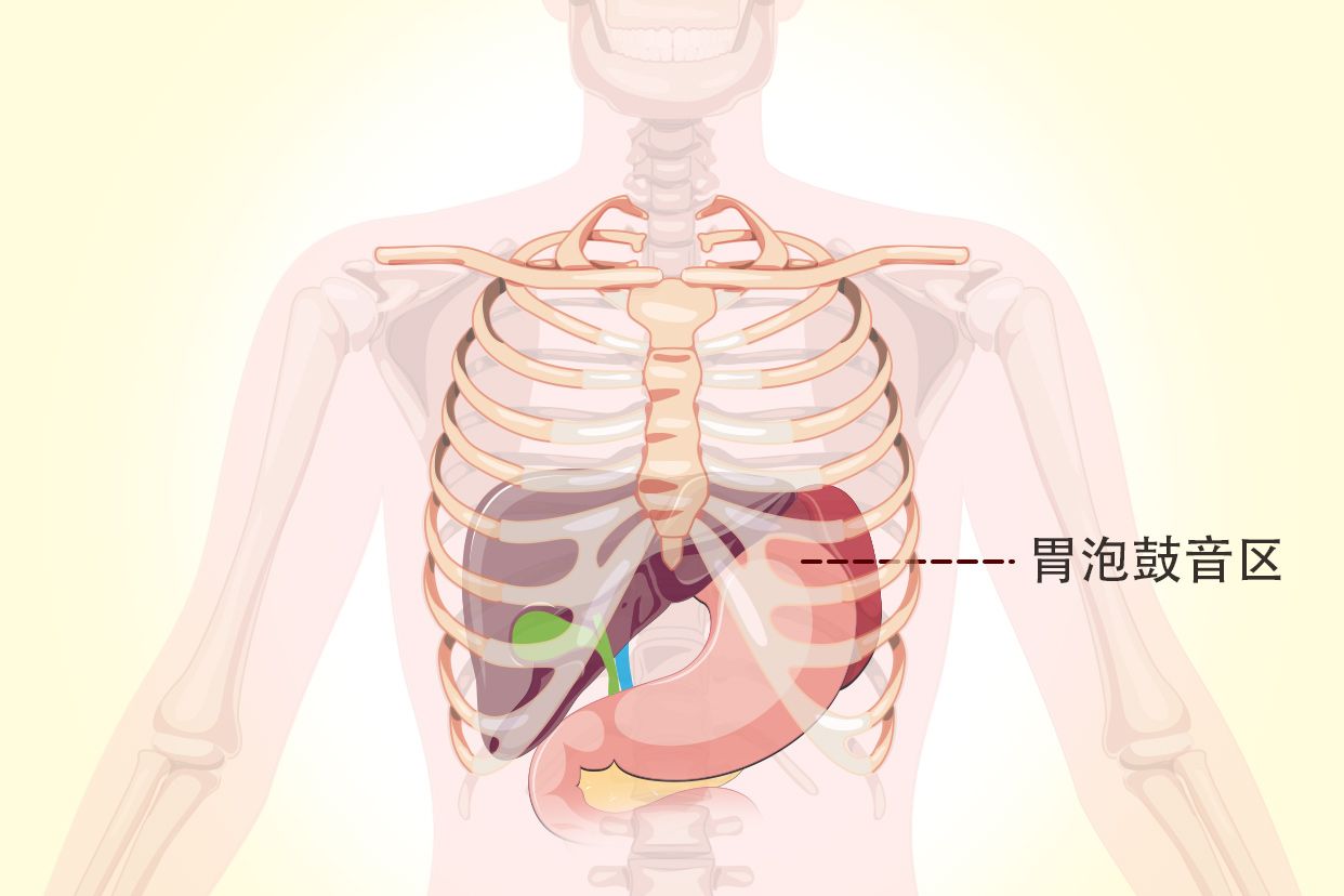 胃泡鼓音区示意图 胃泡鼓音位置示意图