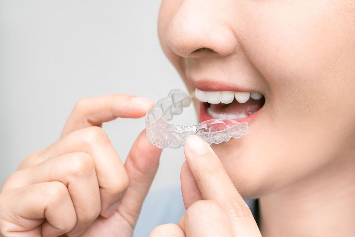 牙釉质透明照片（牙釉质透明图片）