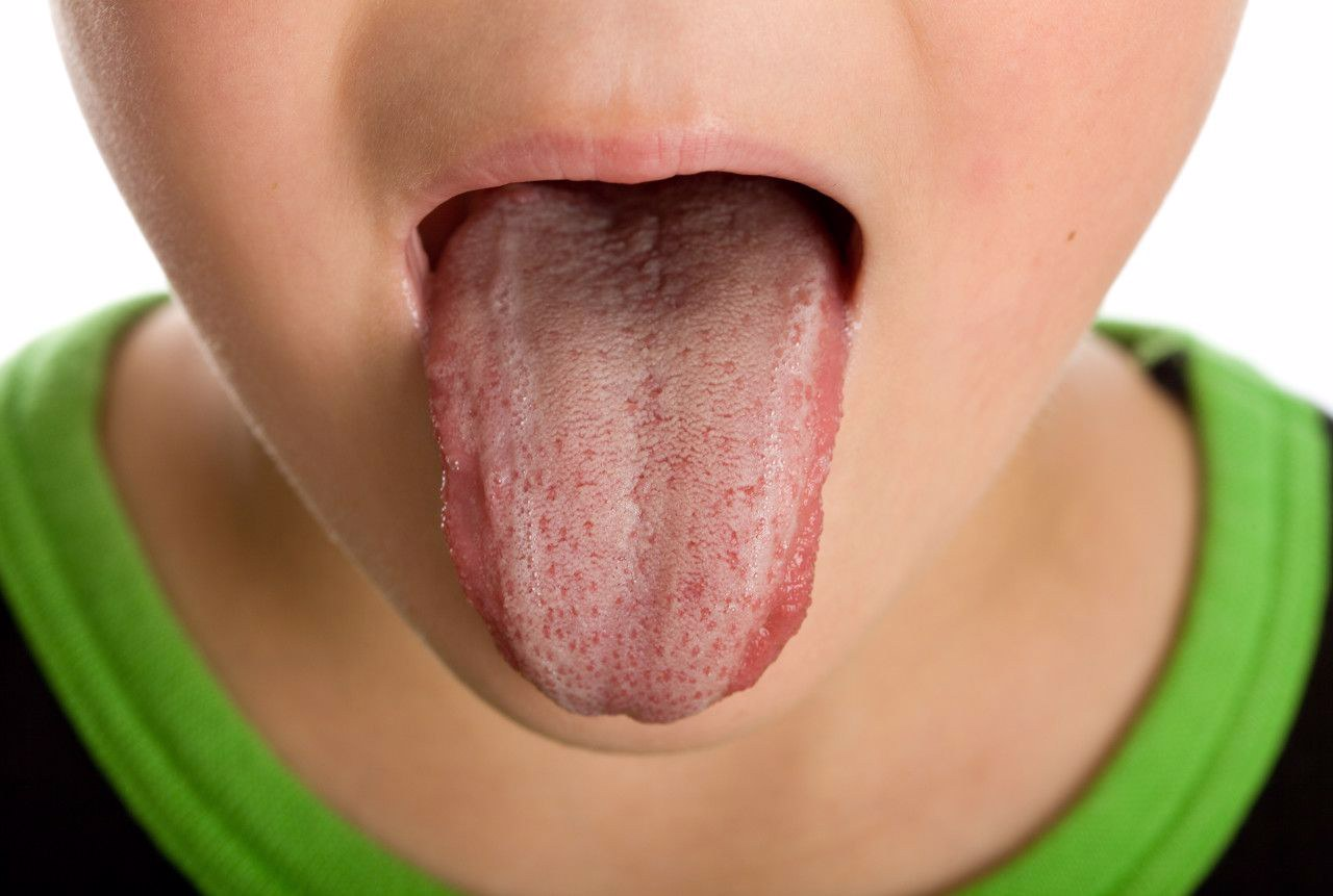 舌头上两边两条竖线图片（舌头上两边两条竖线图片女）
