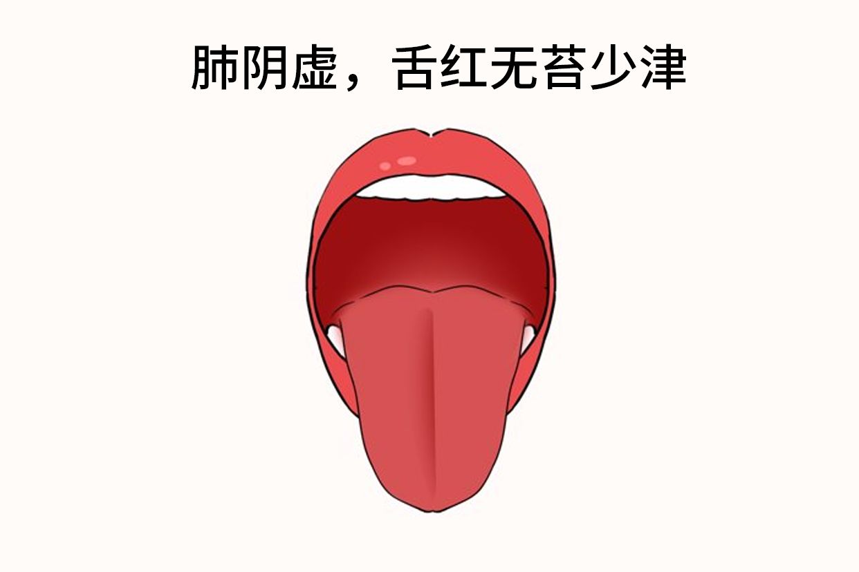 肺阴虚的舌头图片（肺气虚舌头图片）