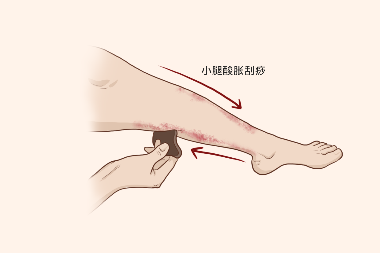 小腿酸胀刮痧的方法示意图（小腿刮痧的正确方法视频教程）