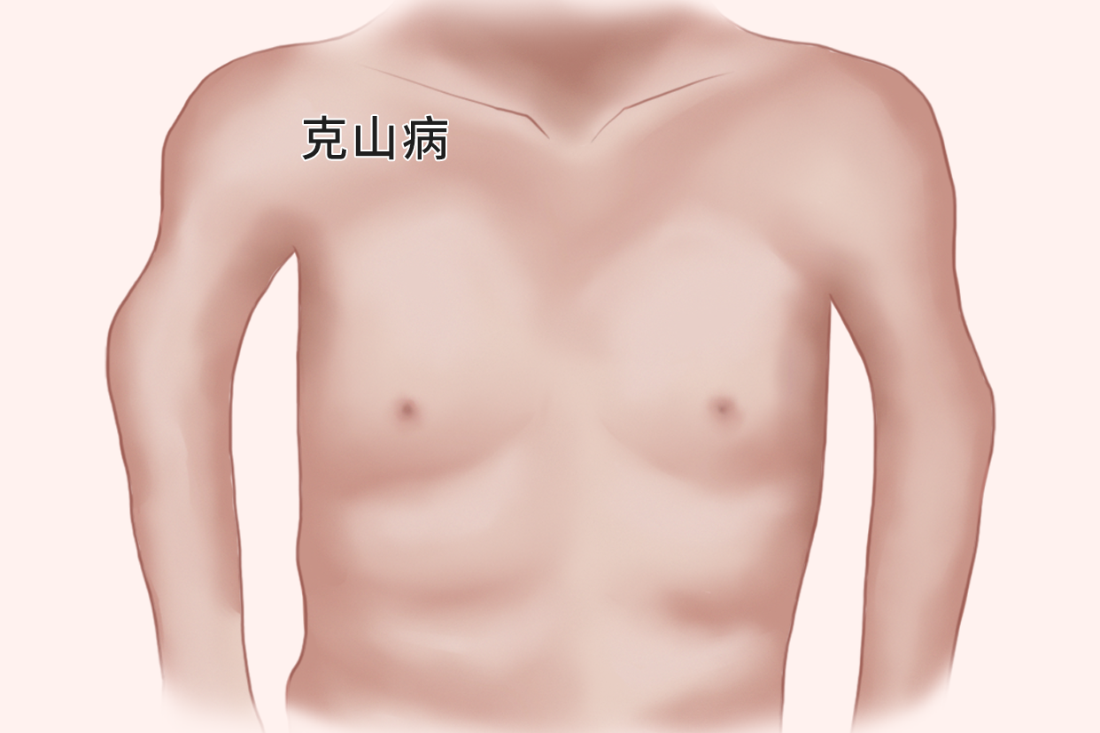 人体缺硒容易得什么病呢图片 人体缺硒容易得什么病呢图片视频