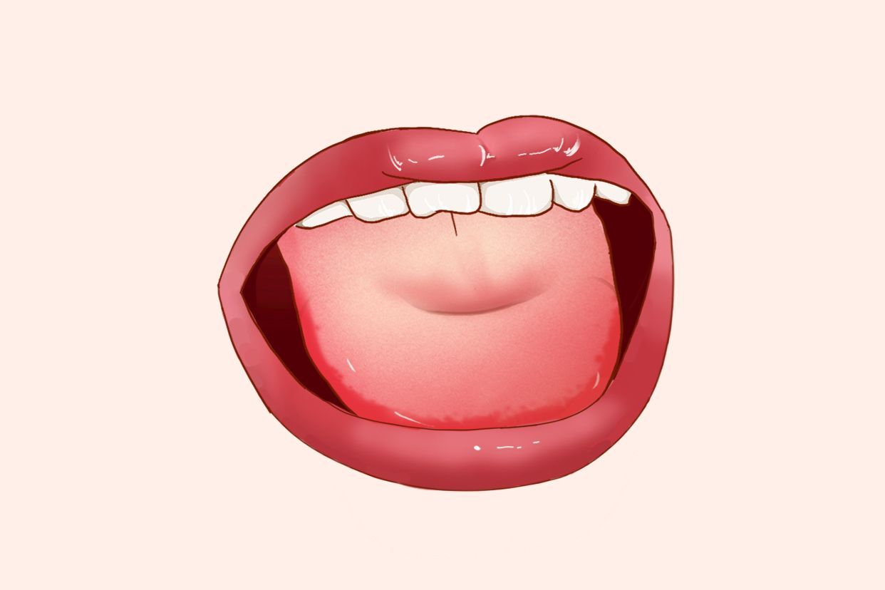 痿软舌图片（痿软舌多见于）