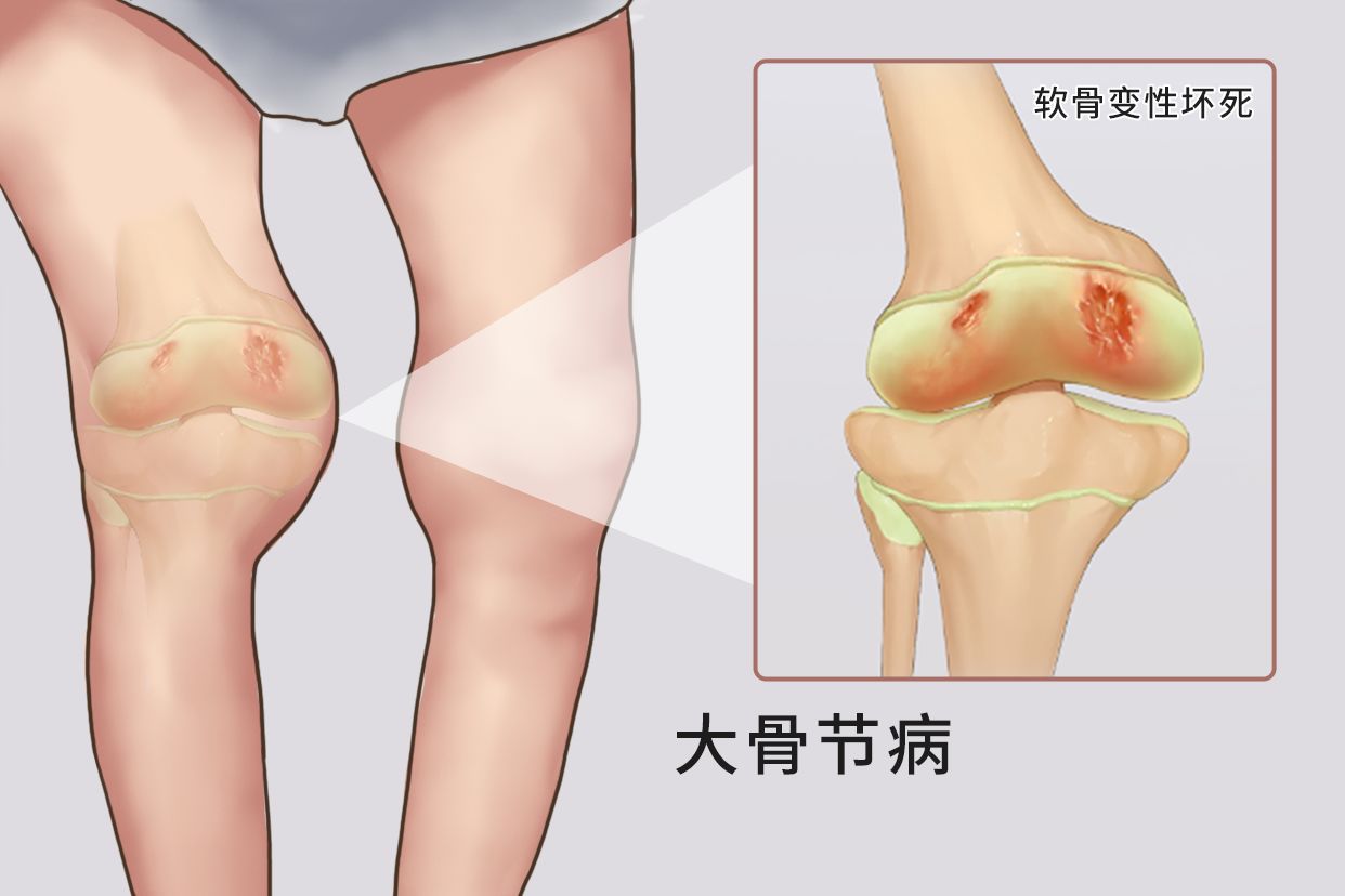 人体缺硒容易得什么病呢图片