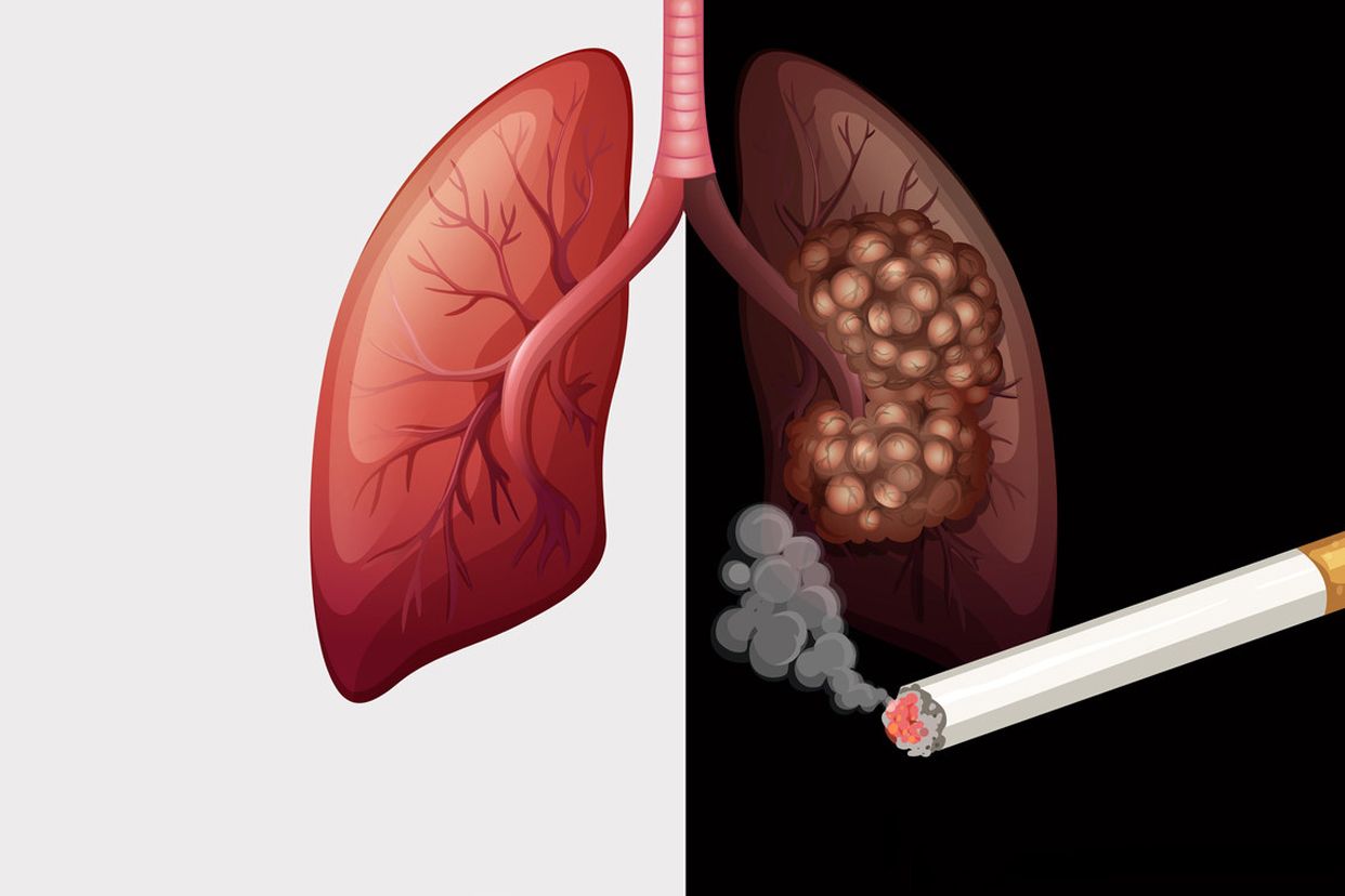 烟草引起癌症的图片 烟草引起肺癌的原因