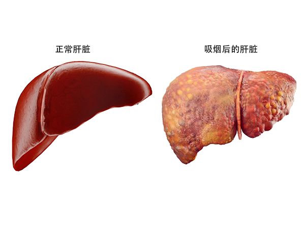吸了烟后的肝脏图片 吸烟之后的肝脏的图片